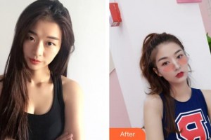 邯鄲華美醫(yī)療美容醫(yī)院陳穎整形價(jià)格表附眼部綜合案例展示