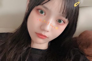 豐臺(tái)右安門(mén)醫(yī)院顴骨手術(shù)|附果圖+新版價(jià)格表