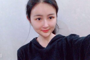 廣東美恩整形美容醫(yī)院下頜角手術(shù)附果圖！