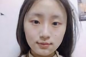 北京圣嘉榮醫(yī)療美容醫(yī)院口碑怎么樣？附案例分享|醫(yī)生推薦