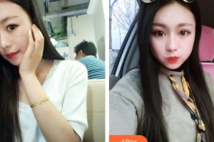 邯鄲凱潤(rùn)婷整形美容醫(yī)院馬戰(zhàn)勝整形價(jià)格表附切開(kāi)雙眼皮案例展示