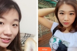 漢口愛爾眼科醫(yī)院李璟整形價(jià)格表附眼部綜合案例展示