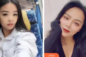 漢口愛爾眼科醫(yī)院常曉可整形價(jià)格表附眼部綜合案例展示