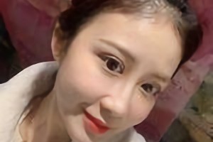 南京醫(yī)科大學友誼整形外科醫(yī)院怎么樣?附下頜角案例分享