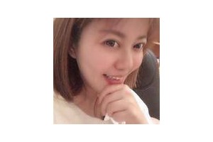 濰坊醫(yī)學(xué)院整形醫(yī)院是公立還是私立？下頜角果過分享