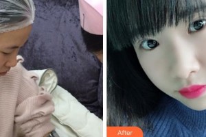 深圳愛爾眼科醫(yī)院柯妍整形價格表附切開雙眼皮案例展示