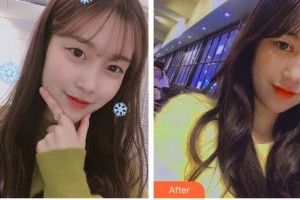 深圳?，斄猪槼毖劭漆t(yī)院尼思特整形價格表附眼部綜合案例展示