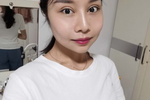 北京麗都醫(yī)療美容醫(yī)院顴弓外擴整形果？真實案例對比