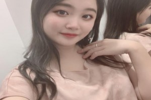 韓國(guó)Face-line整形醫(yī)院顴骨整形恢復(fù)果怎么樣附對(duì)比圖