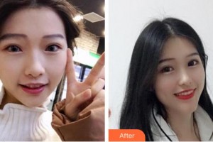 東莞特美口腔門診部歐陽軍輝整形價(jià)格表附牙齒隱形矯正案例展示