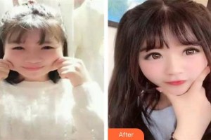 東莞愛爾眼科醫(yī)院劉斐整形價格表附埋線雙眼皮案例展示