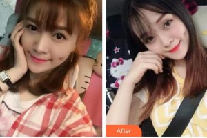 東莞愛爾眼科醫(yī)院譚泳昌整形價格表附眼部整形案例展示