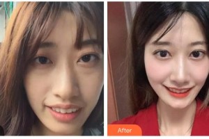 東莞恒生口腔門診部張帝整形價格表附牙齒陶瓷矯正案例展示