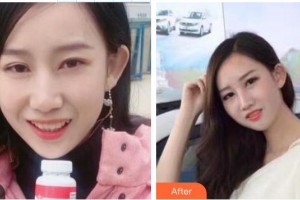 東莞拜爾口腔門診部陳亞軍整形價格表附口腔牙齒矯正案例展示