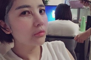 杭州市三醫(yī)院熱瑪吉果怎么樣附2021價(jià)格一覽