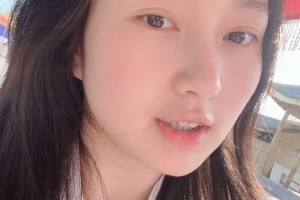 濟(jì)寧附屬醫(yī)院整形科下顎角感覺(jué)怎樣？真人案例圖片對(duì)比