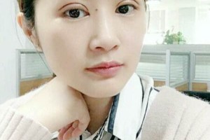 邯鄲三院做雙眼皮怎么樣附果圖|價(jià)格表