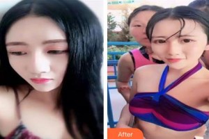 新津志輝醫(yī)院醫(yī)療美容科余科整形價格表附肋軟骨隆鼻案例展示