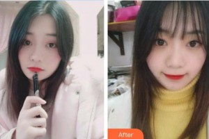 梅河口百顏醫(yī)療美容醫(yī)院王一學(xué)整形價格表附牙齒隱形矯正案例展示