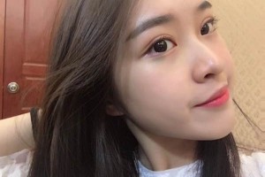 南京柏盛醫(yī)院雙眼皮手術(shù)果對比圖展示 附價(jià)格表一覽