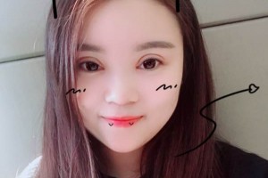 北京中日友好醫(yī)院怎么樣？附雙眼皮手術(shù)果圖