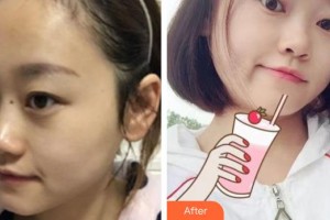 楚雄現(xiàn)代婦產(chǎn)醫(yī)院醫(yī)療美容科賈萬(wàn)榮整形價(jià)格表附微針?biāo)獍咐故?>
</a>
<h3 class=