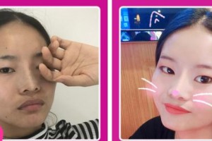 樊枝花凝美醫(yī)療美容診所宋勇整形價(jià)格表附光子嫩膚案例展示