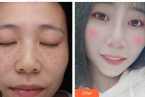 武威市涼州醫(yī)院整形美容科陶俊生整形價(jià)格表附微針美膚案例展示