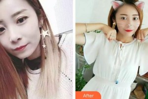 西藏阜康醫(yī)院口腔科趙霞整形價格表附牙齒隱形矯正案例展示