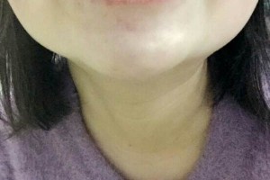 哈爾濱圣安口腔醫(yī)院怎么樣？附牙齒矯正果圖