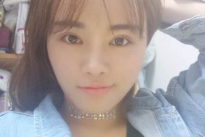 杭州117醫(yī)院整形科主任雙眼皮怎么樣？附果圖展示