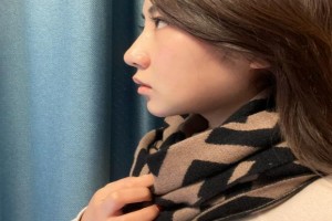 湘雅附二醫(yī)院美容科怎么樣磨骨瘦臉恢復(fù)果分享