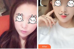 毛志祥整形價(jià)格表附無針?biāo)獍咐故?>
</a>
<h3 class=