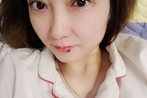 上海復(fù)美醫(yī)療美容門診部割雙眼皮日記|價格表