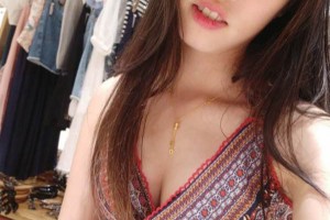 鄭州人民醫(yī)院整形科雙眼皮怎么樣？附手術(shù)果圖及收費(fèi)標(biāo)準(zhǔn)