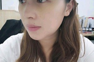 浙醫(yī)一院整形科怎么割雙眼皮案例和價(jià)格一覽