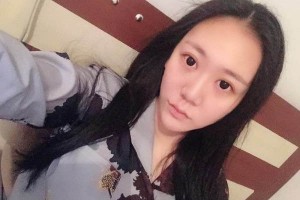 北京煦氰醫(yī)院正規(guī)嗎割雙眼皮全過(guò)程分享|價(jià)格表