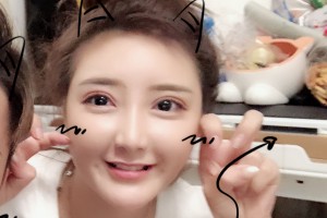 新橋醫(yī)院割雙眼皮恢復(fù)果怎么樣|醫(yī)生推薦|價(jià)格表