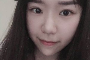 南京中大整形醫(yī)院光子嫩膚好不好？附果圖