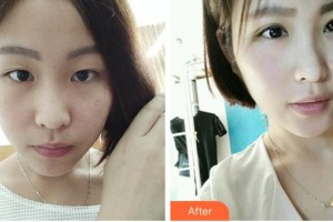 石首華美整形醫(yī)院丁洪芳整形價(jià)格表附眼部案例展示