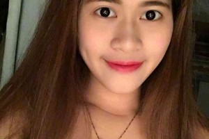 湖南株洲中心醫(yī)院整形科？雙眼皮術(shù)后注意事項！