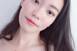 無錫中醫(yī)院整形科如何？雙眼皮成功案例測評分享！