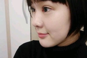 武漢天佑醫(yī)院整形雙眼皮行不行？真人圖片對(duì)比+醫(yī)生推薦