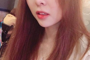 鄭州集美整形醫(yī)院隆鼻真人案例+醫(yī)生介紹！