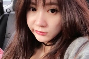 天津一中心整形外科隆鼻怎么樣？真人案例+醫(yī)生介紹