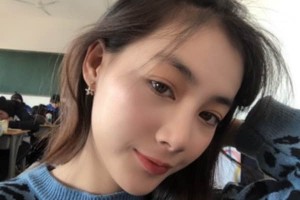 蘇州附二醫(yī)院整形科下頜角術(shù)后果？醫(yī)生推薦&費(fèi)用表