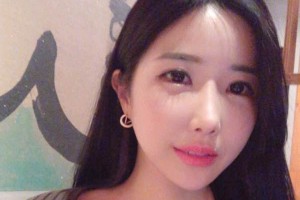 襄陽(yáng)市中心醫(yī)院整形科下頜角術(shù)后果？較新價(jià)格表