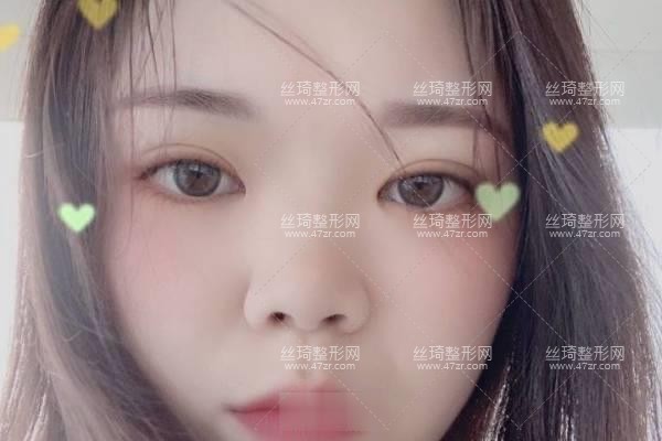 哈爾濱醫(yī)大二院正規(guī)嗎好不好？鼻部手術(shù)價(jià)目表和醫(yī)生推薦