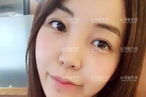 寧波第三醫(yī)院整形科雙眼皮案例知名醫(yī)生推薦