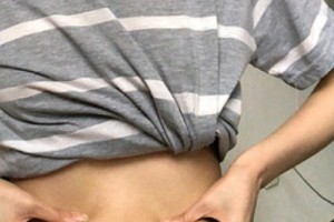 武漢涵美整形醫(yī)院怎么樣？吸脂減肥實(shí)拍—術(shù)后恢復(fù)